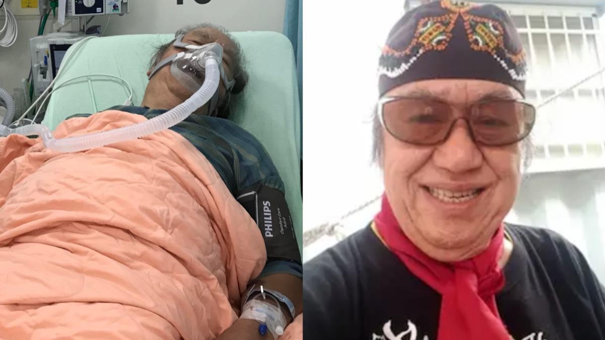 唱將昏迷8小時險送命!腎結石成心肌梗塞 醫曝1關鍵:心腎一體