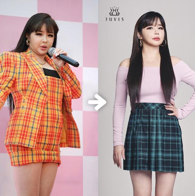 2NE1朴春在2021年，朴春就曾成功減重，從70公斤瘦回59公斤。（圖／翻攝自IG@newharoobompark）