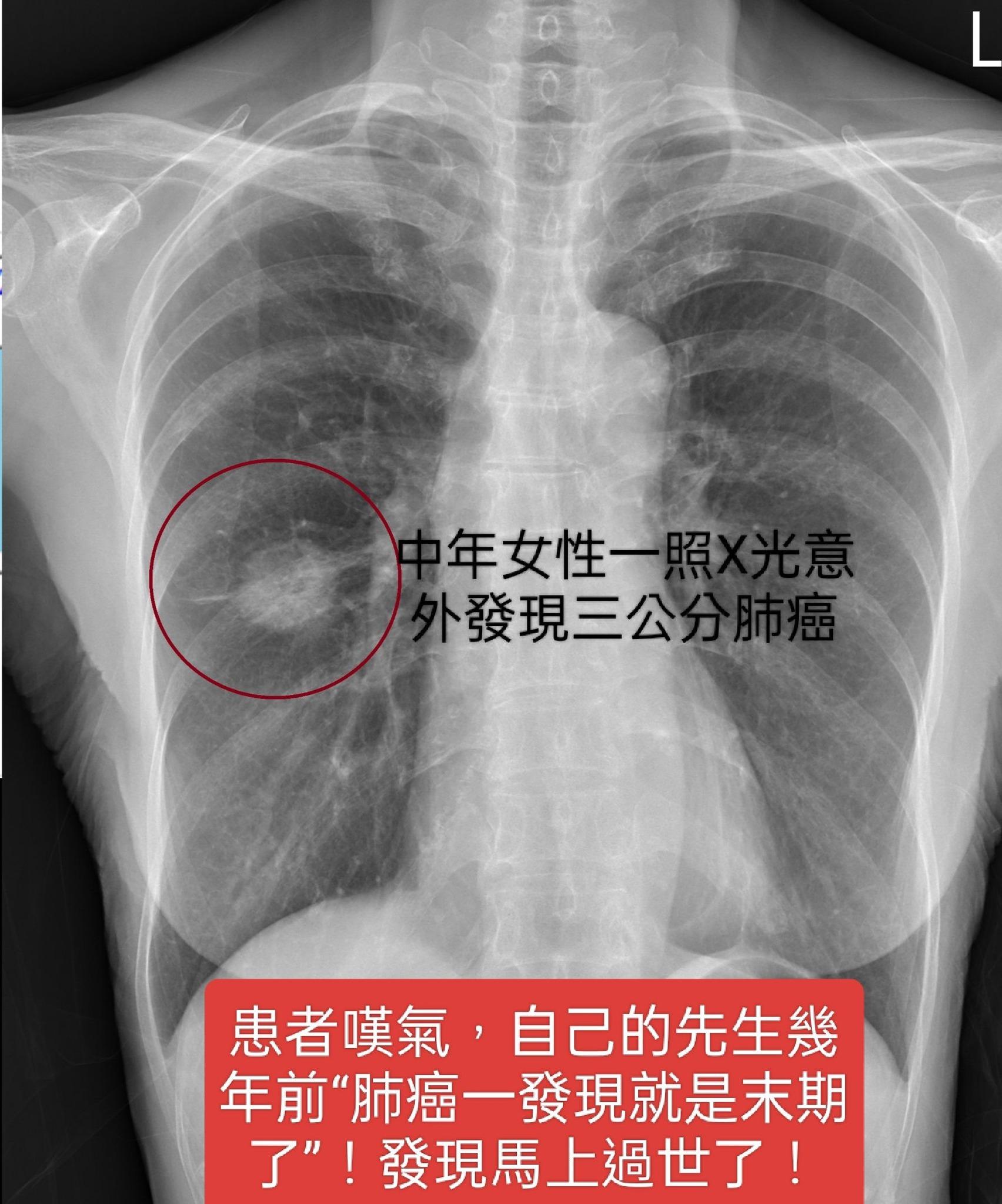 女性受到菸品的危害高於男性。(圖/翻攝自「蘇一峰」臉書)