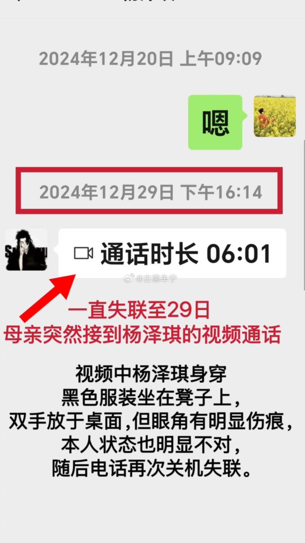 楊澤琪視訊時帶傷。（圖／翻攝自微博）