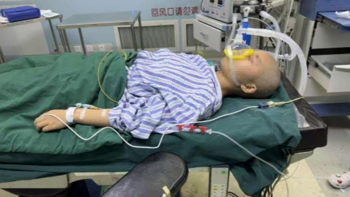 父親全身95%燒傷 女兒剃髮「割整片頭皮」救父:用全身皮也願意