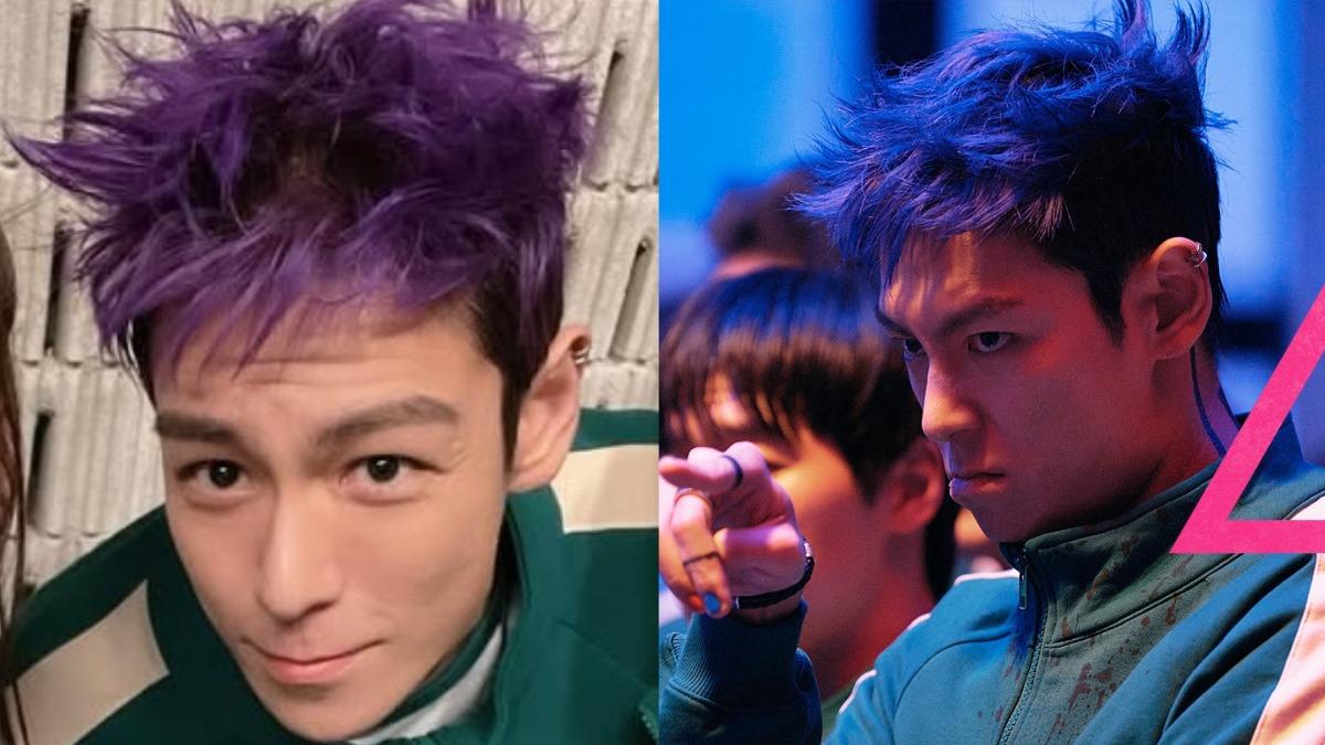 T.O.P.拍《魷魚2》弄斷肋骨!醫曝「痛到厭世」慘況 動1手術助復原