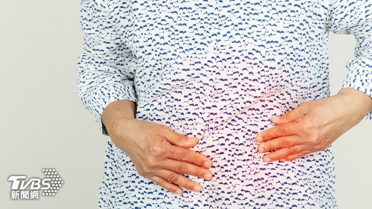 腹痛20年沒當回事 陸婦就醫竟從膽囊取出「400多顆結石」