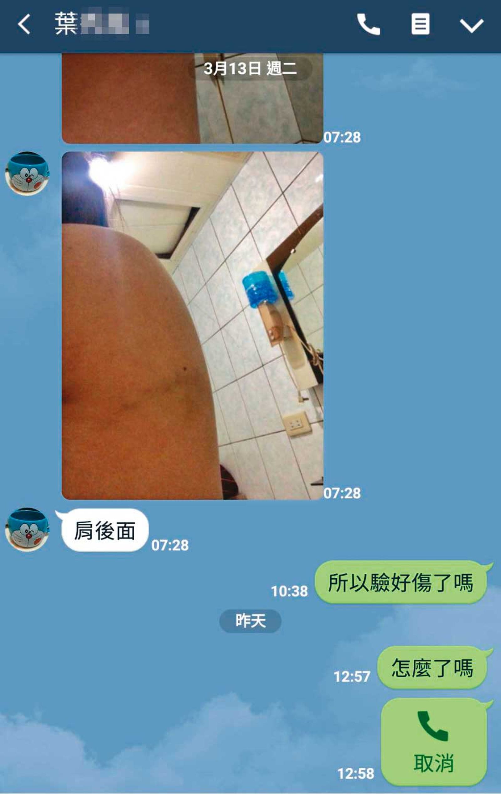 死者肩膀曾被大嫂打傷,她因此準備驗傷提告。(圖/翻攝畫面)