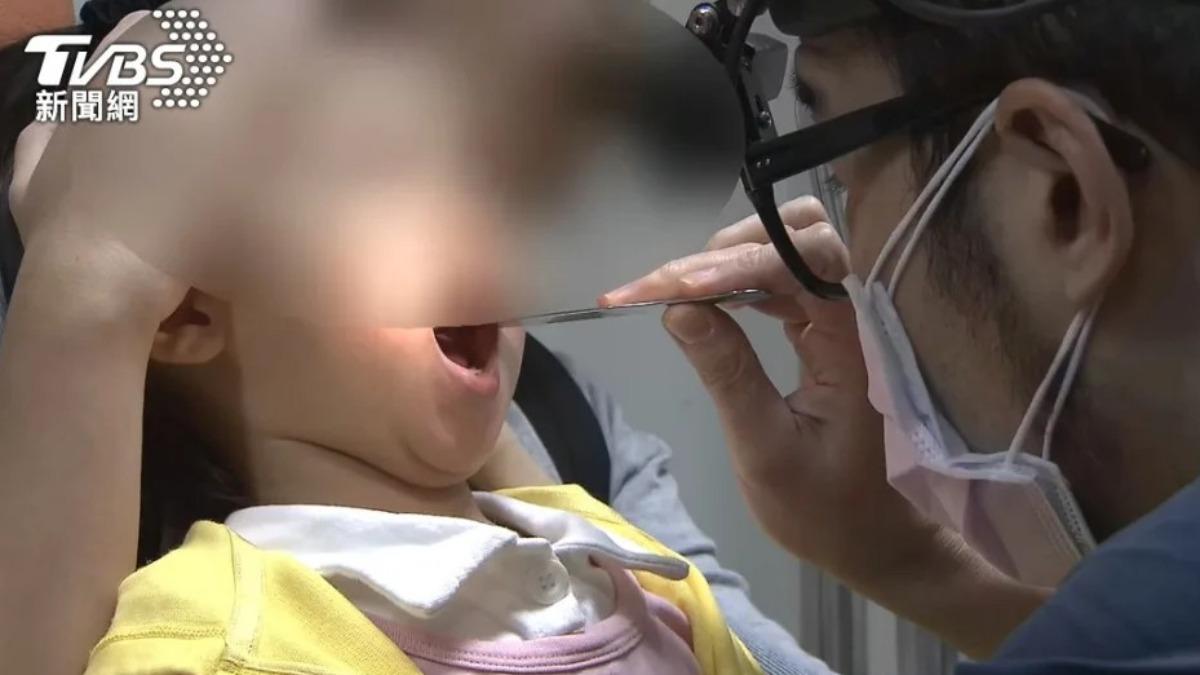 一家4口全感冒　男孩狂流黃鼻涕「醫生夾出秘寶」爸媽嚇壞