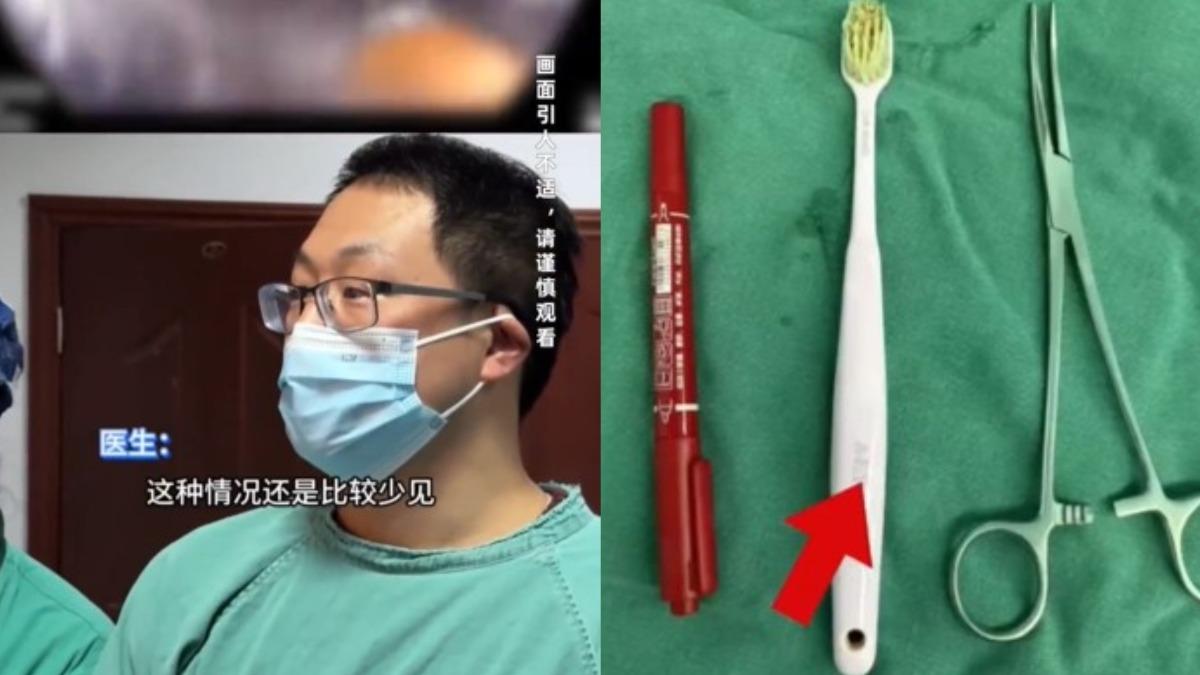 醫生取出牙刷很震驚。(圖/翻攝自微博《新浪新聞》)