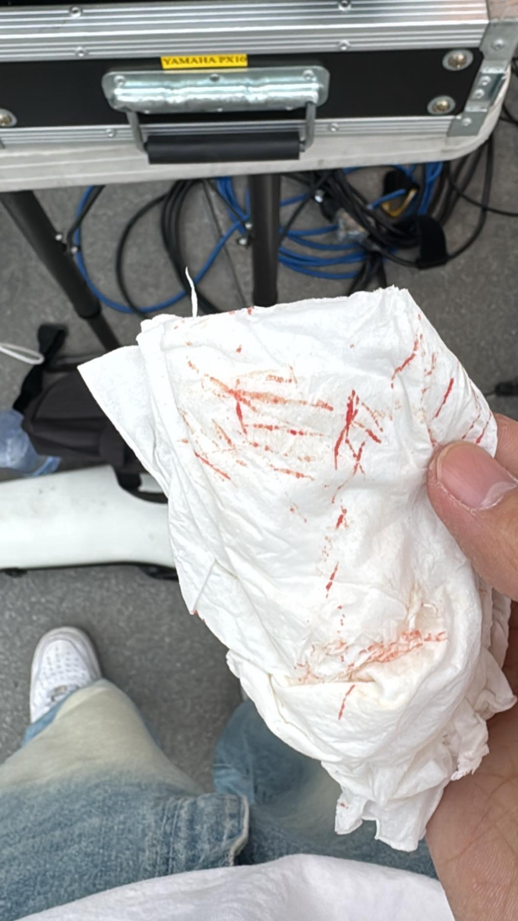 林子安下巴出血。(圖/翻攝自林子安IG)