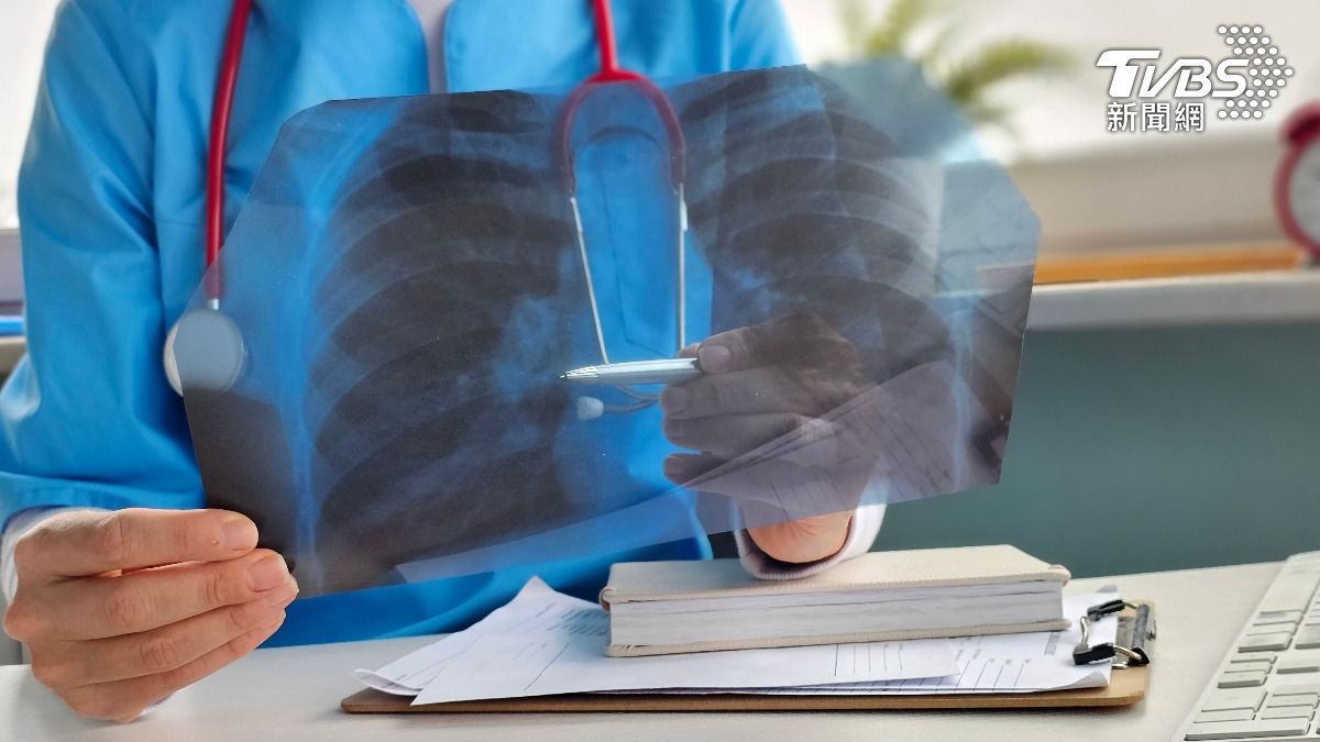目前HPMV在英國的檢測陽性率上升至4.9%。（示意圖／達志影像shutterstock）