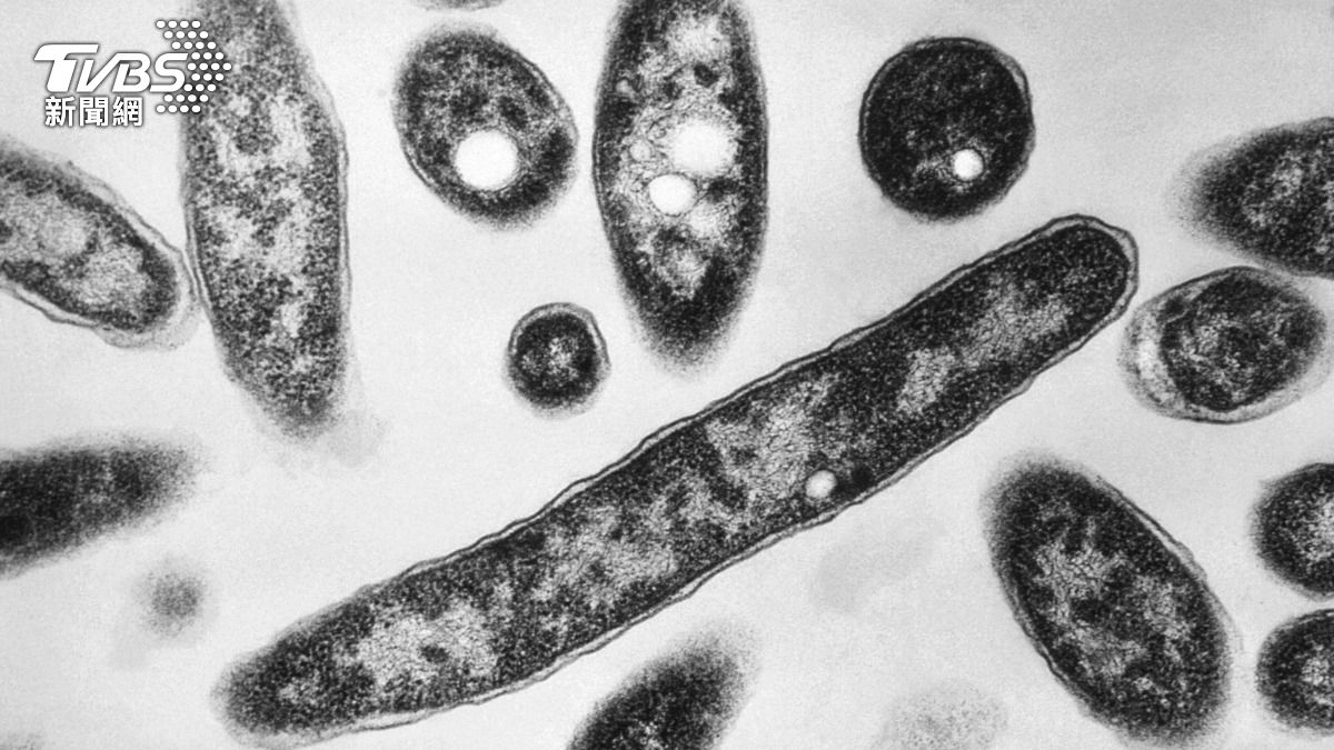 嗜肺性退伍軍人桿菌(Legionella pneumophila)。(圖/達志影像美聯社)
