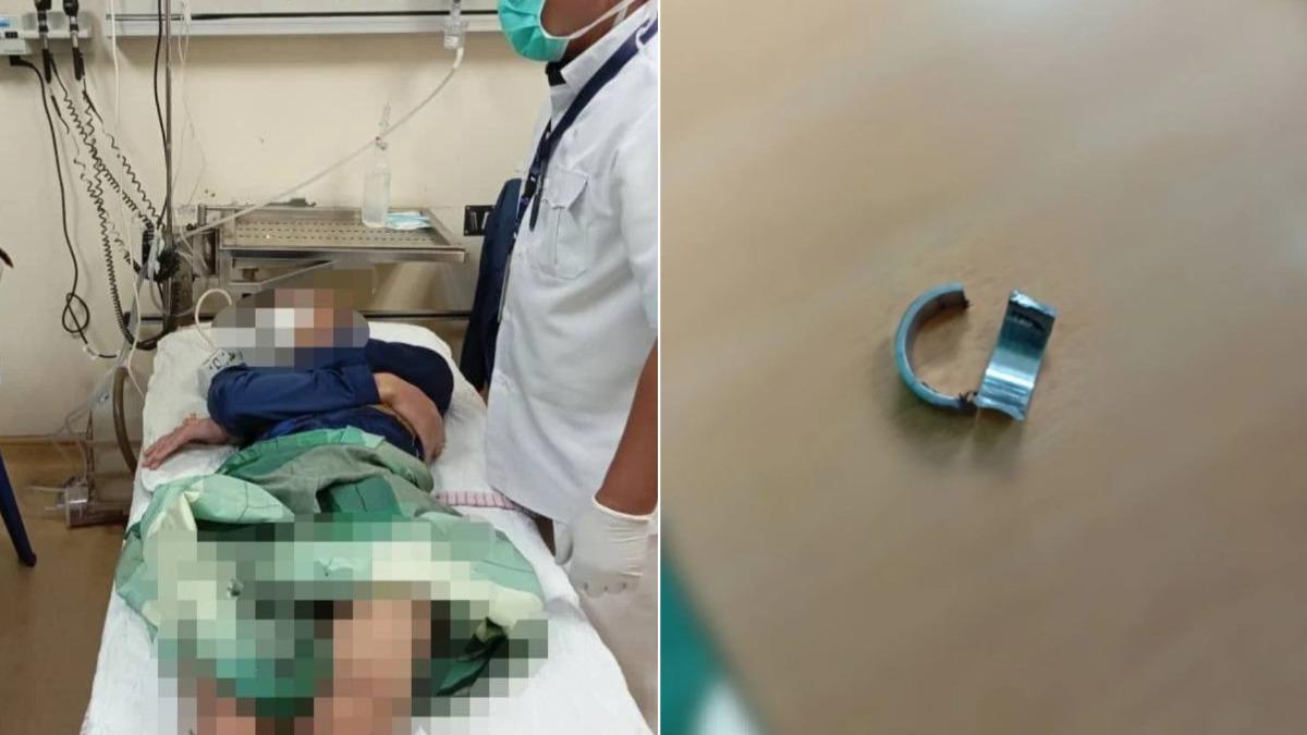 大馬少年「戒指套命根子」卡住 消防員傻眼:鐵剪差點壞掉