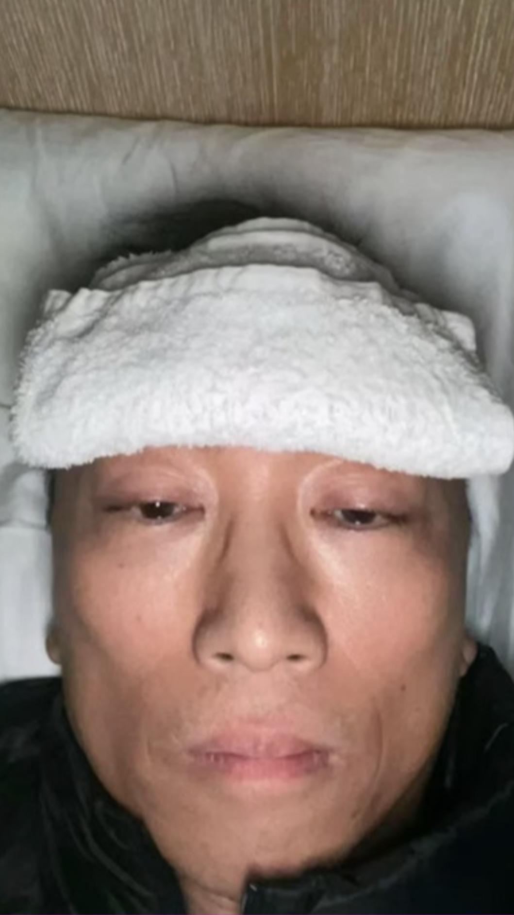 鄔友正上載重病照片，當時病況嚴重。（圖／鄔友正小紅書）  