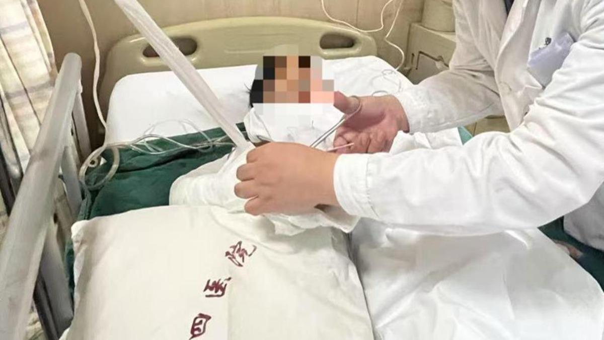 明明目前沒有生命危險,但右手未來可能會在功能、外形等方面出現重大後遺症。(圖/翻攝自極目新聞)