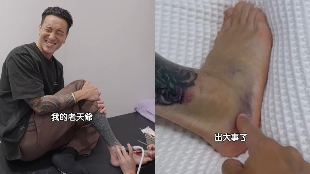 王陽明打球時不慎扭傷腳踝，導致韌帶撕裂和骨裂。（圖／翻攝自王陽明IG）