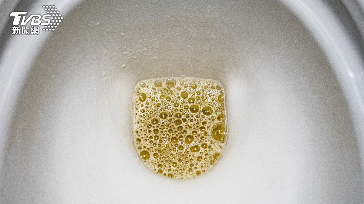 泡泡尿不易破要當心腎?5大症狀趕緊做檢查 疲倦水腫恐已晚期