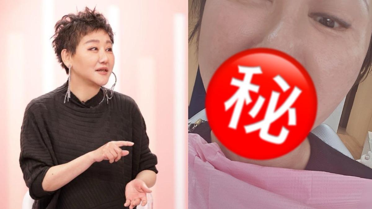 藍心湄才火辣開唱！無預警爆動刀「挖肉」　缺門牙驚人照片曝