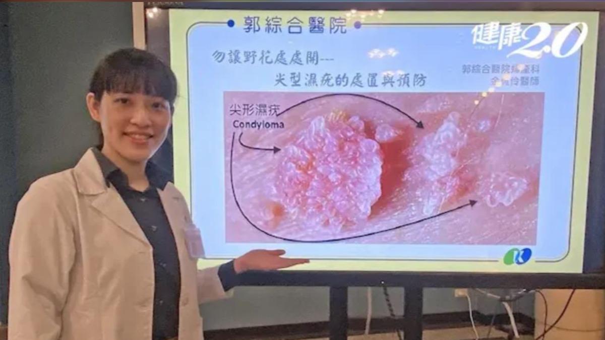 沒性行為也可能感染菜花。(圖/郭綜合醫院提供)