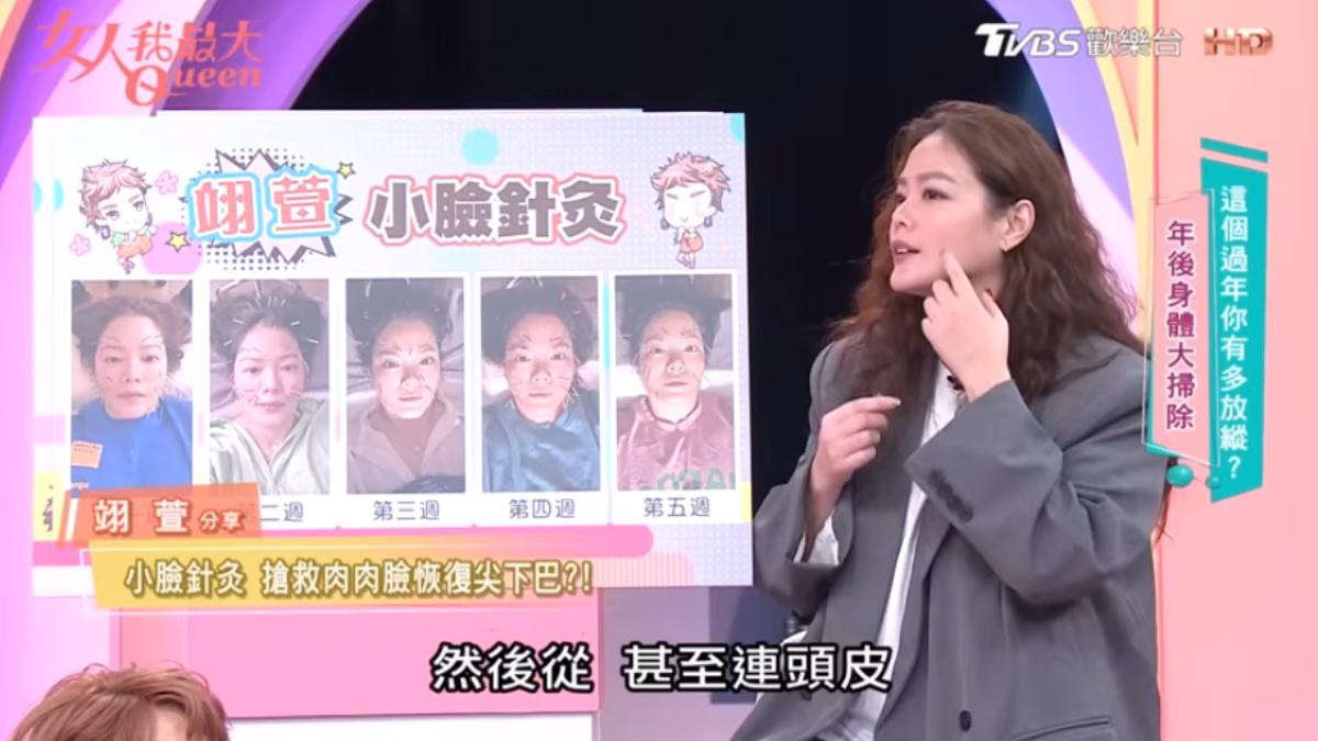 藝人翊萱分享她的年後保養祕訣是小臉針灸,逐步改善臉部線條,重現尖俏的下巴。(圖/翻攝自Youtube頻道@TVBS女人我最大)