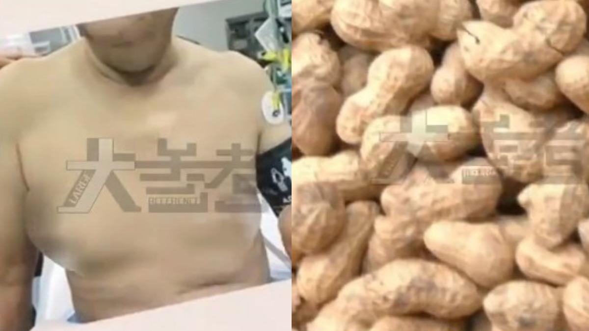每天嗑1公斤花生瓜子！大叔變巨乳　女網友傻眼：現在吃來得及嗎？