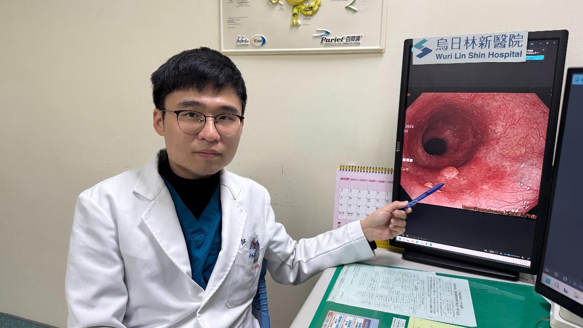 蘇品碩解釋,在台灣大部分食道癌發現已是中晚期。(圖/烏日林新醫院提供)