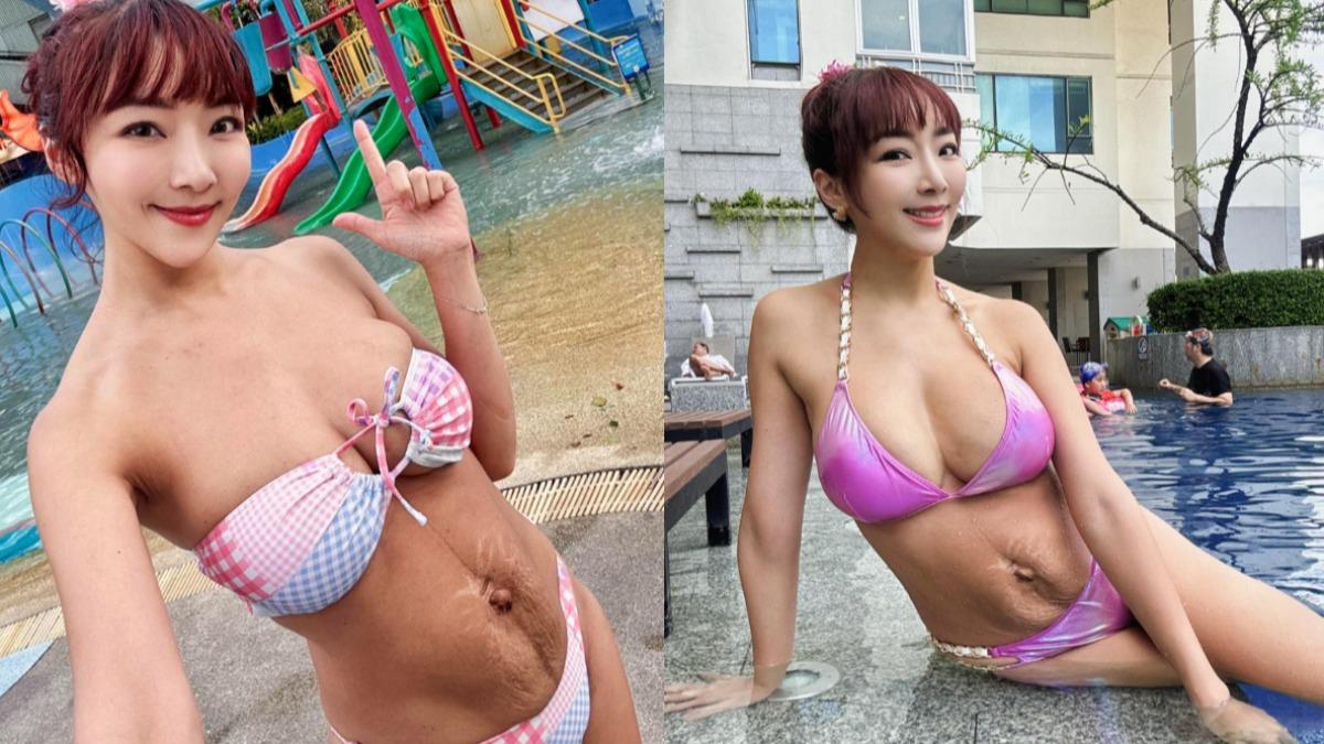 前資生堂千金當5寶媽!產後妊娠紋竟遭酸噁心 突宣布動手術
