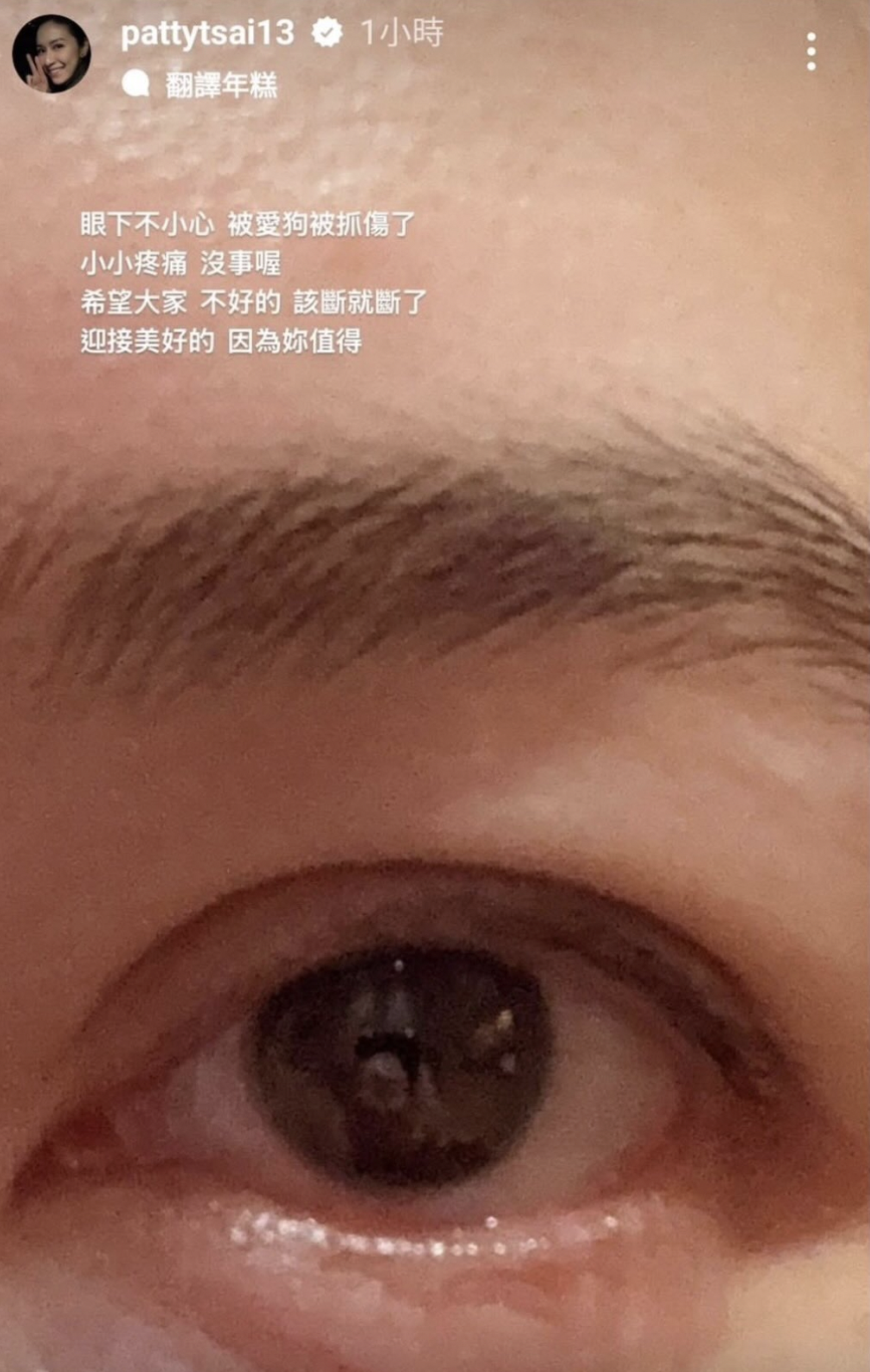 蔡依珊昨日在限動表示自己眼下被愛犬抓傷,又感嘆「該斷就斷了」,隨後刪除動態。(翻攝自IG@pattytsai13)