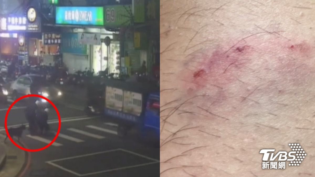 好衰!新北男穿內褲馬路狂奔 警保護他反遭「小黑」狠咬
