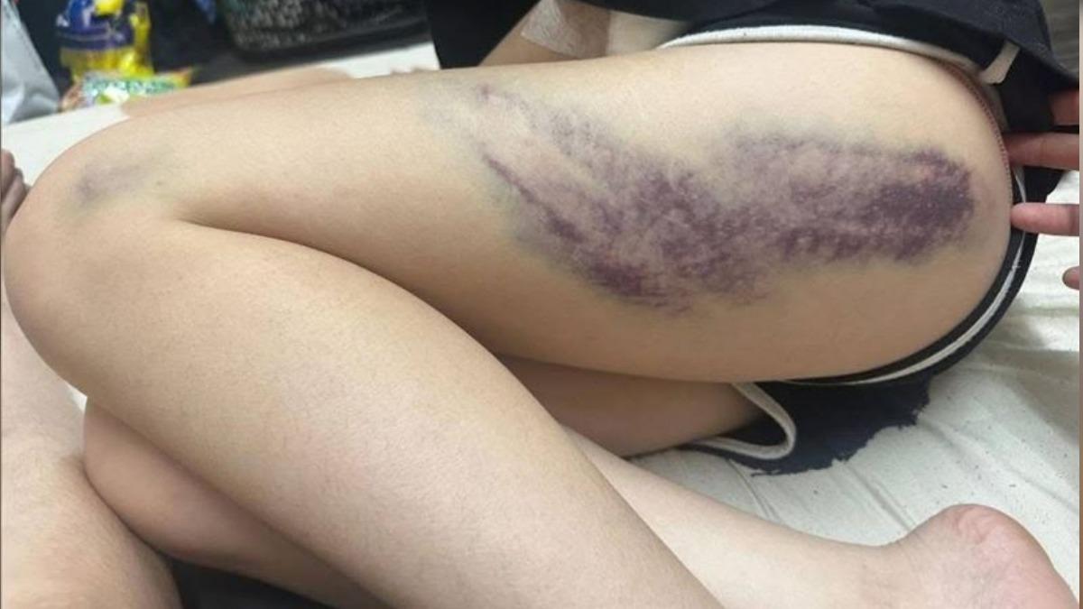 女員工遭胡凱彬動用私刑毆打。(圖/翻攝自臉書爆料公社)