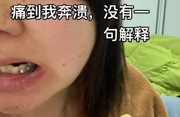 醫師拔智齒卻將一旁的好牙也拔掉。(圖/翻攝自微博)