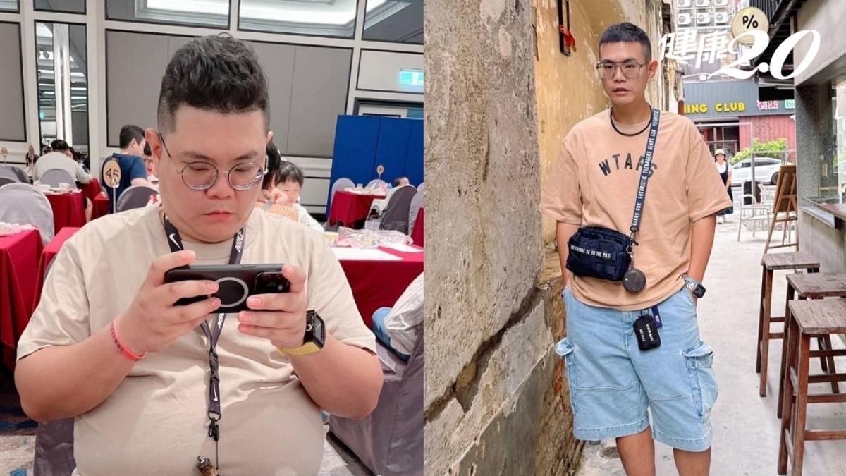 因病態性肥胖導致多項健康問題,最終決定採取微創手術的方式。(圖/亞東醫院提供)