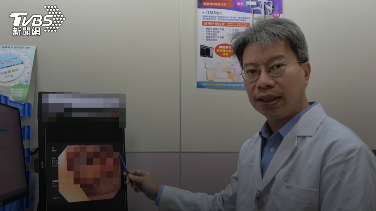 平常愛喝酒!40多歲男腹痛吐5天 醫一查:大腸癌末期