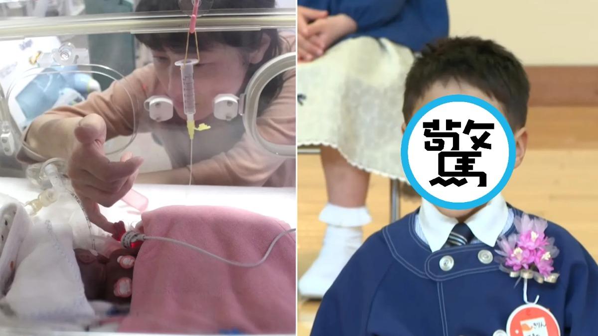 出生僅258克!世界最輕「巴掌寶寶」6歲了 長大模樣曝光:想當警察