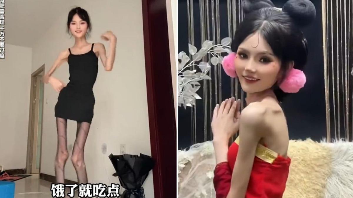 妹子160公分僅25公斤成紙片人 「我愛骨感還想瘦下去」
