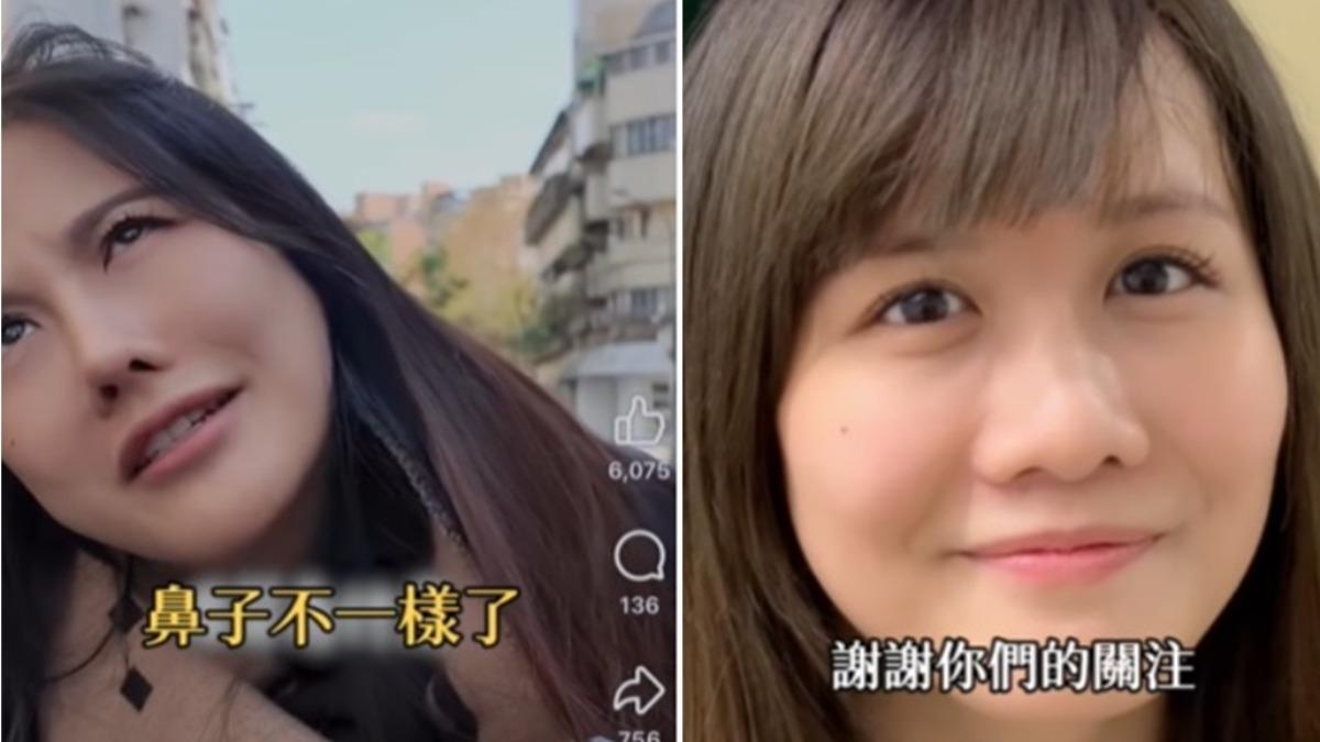 蕭小M透露,被網友酸「鼻子變形了」。(圖/翻攝蕭小M IG)
