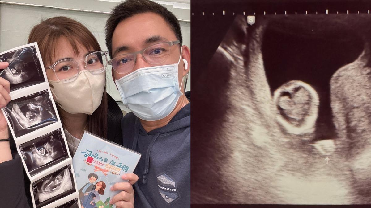 八點檔女星懷孕了!超音波照藏「愛心」 嗨喊:二寶來找我們啦