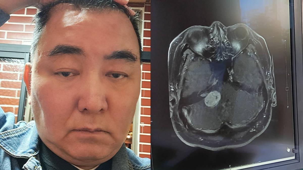徐亨今晨發文透露自己罹患腦瘤。（圖／翻攝自徐亨臉書）
