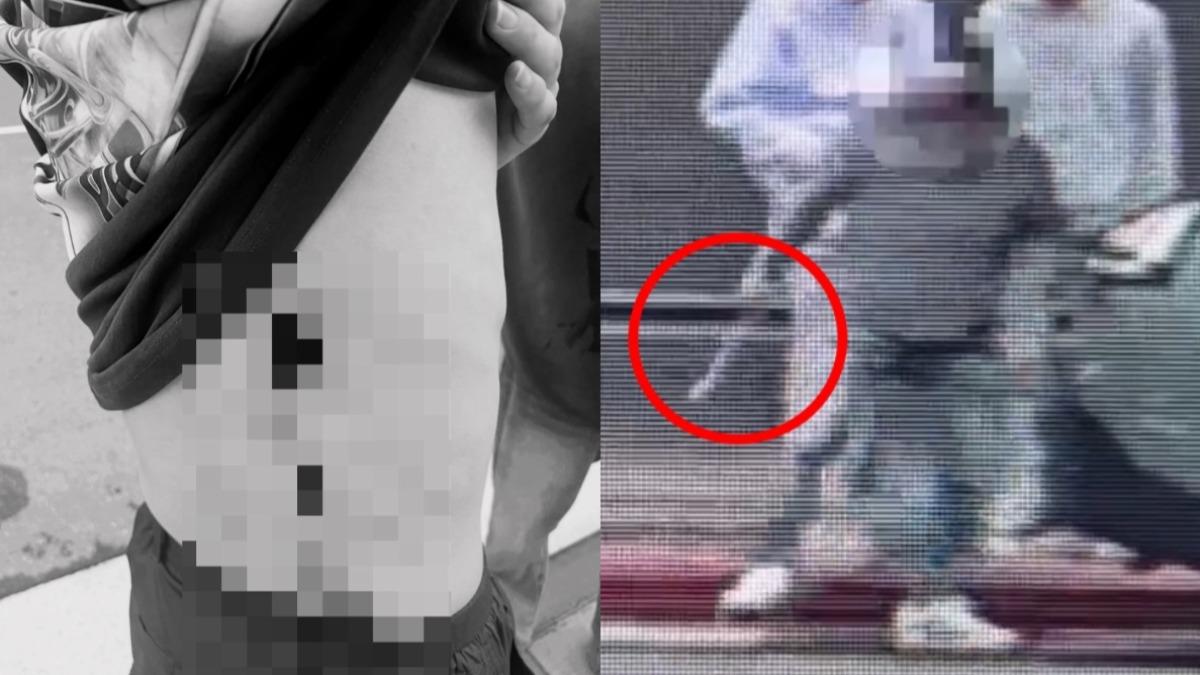 韓籍留學生西門町無故遭砍!無奈嘆:到現在還是無法相信