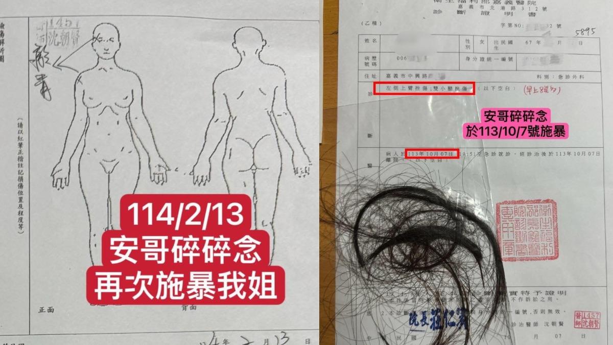 女方家屬曝光多張驗傷單,指控「安嫂」是被家暴(圖/翻攝安哥臉書)