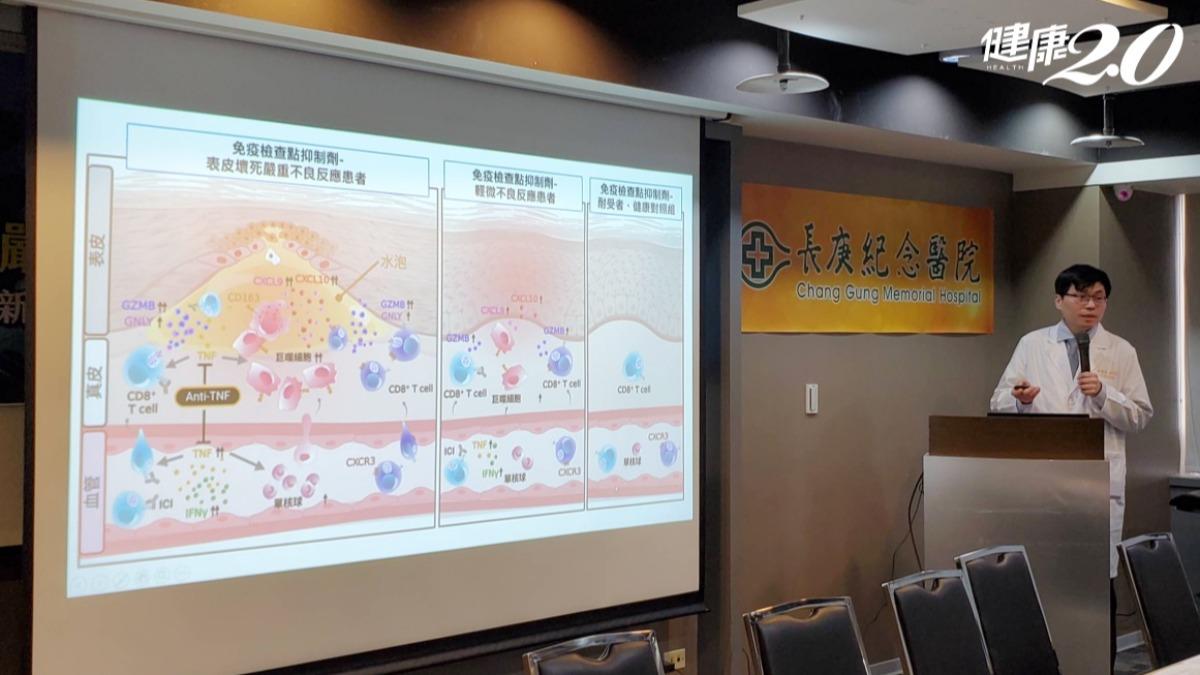 長庚醫院陳俊賓醫師說明免疫治療引起不良過敏反應的機轉。(圖/健康2.0)