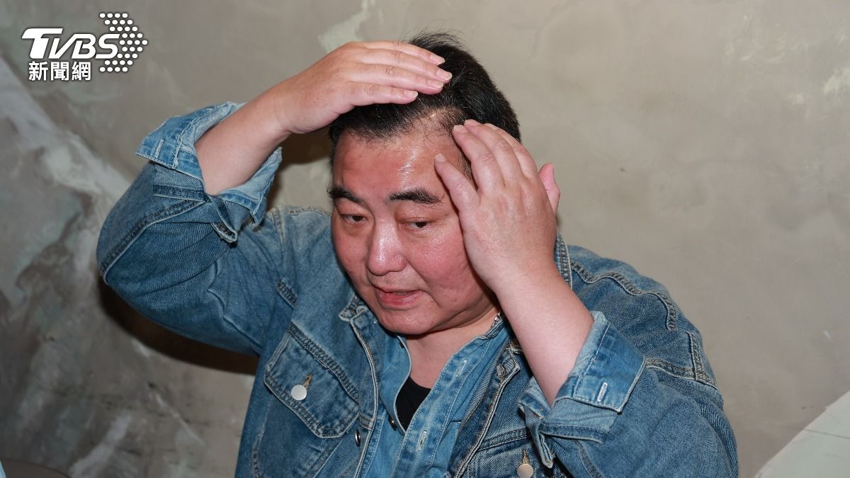 徐亨頭裡有裝導流管。(圖/黃城碩攝)
