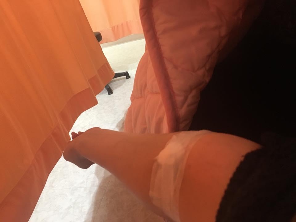 劉涵竹,劉涵竹腫瘤,劉涵竹手術,美女主播手術,美女主播腫瘤,美女主播劉涵竹,子宮肌瘤,子宮息肉