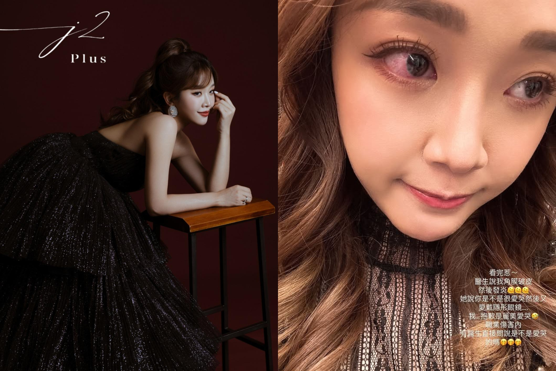 賴慧如明日舉辦婚禮,眼睛卻突然布滿血絲。(圖/J2 Plus 婚紗攝影提供、翻攝自賴慧如IG)