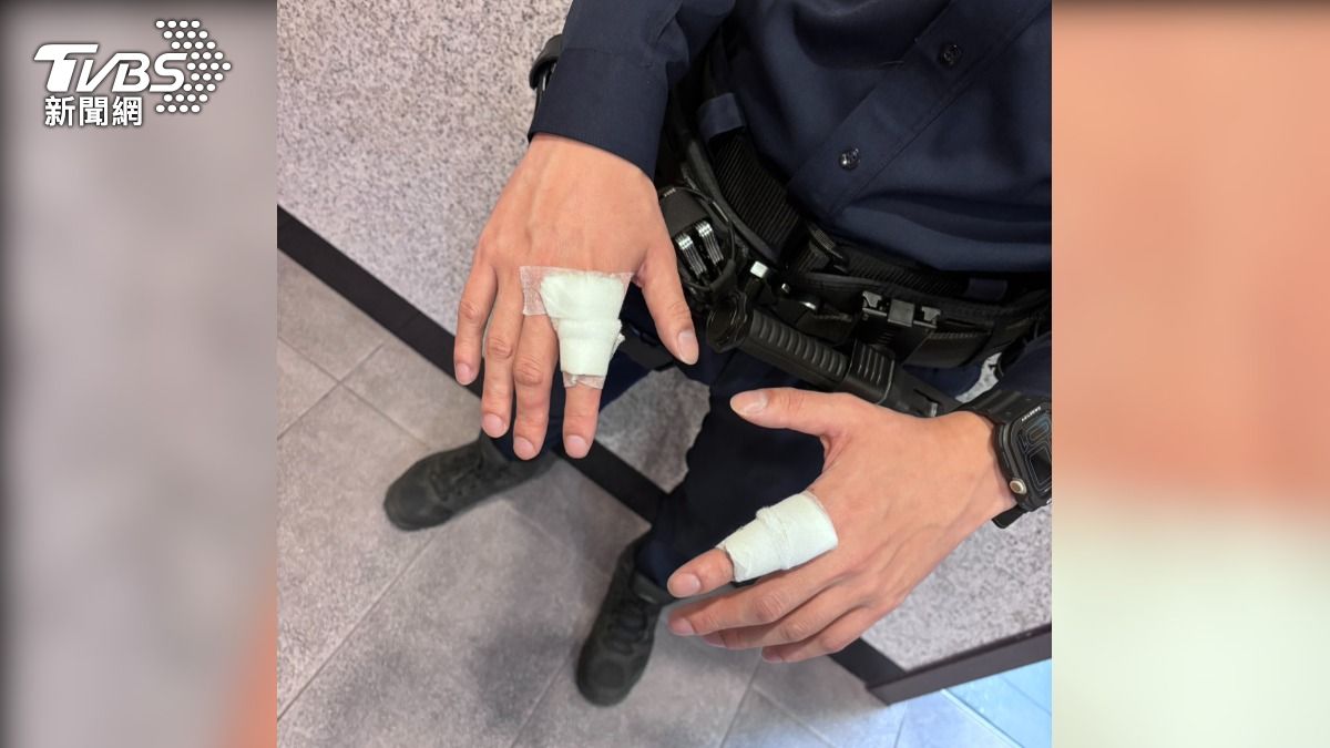 員警遭機車騎士攻擊造成手部擦傷。(圖/TVBS)