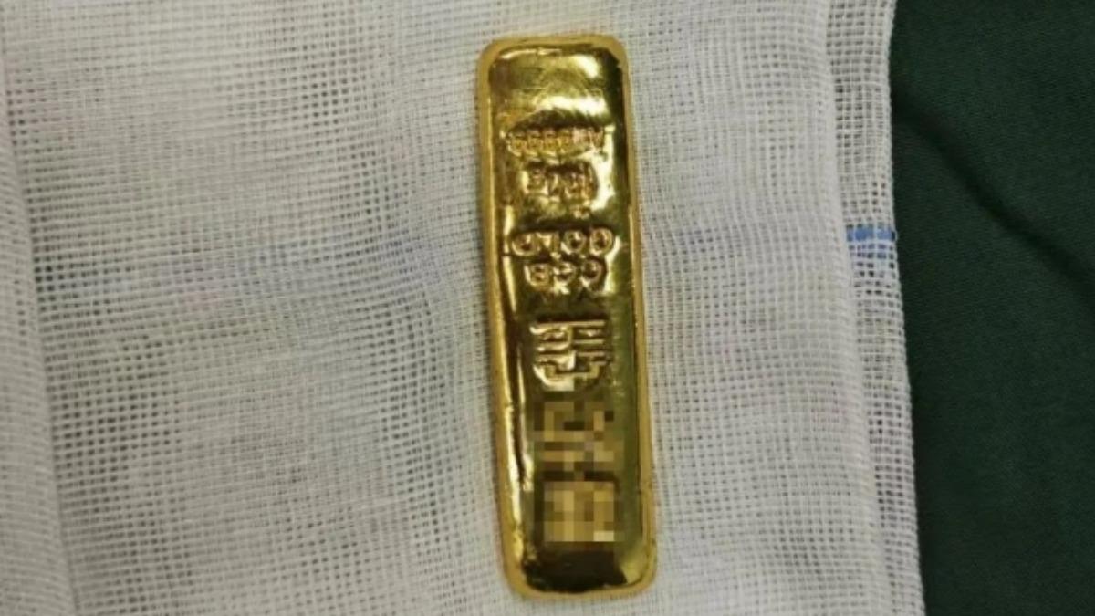 男童手術後體內取出的金條。(圖/瀟湘晨報)