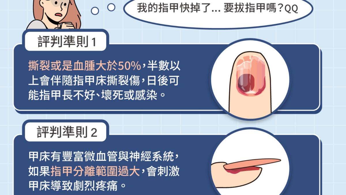 急診的「拔指甲」標準。(圖/翻攝自fb「急診柯南.翁梓華醫師」)