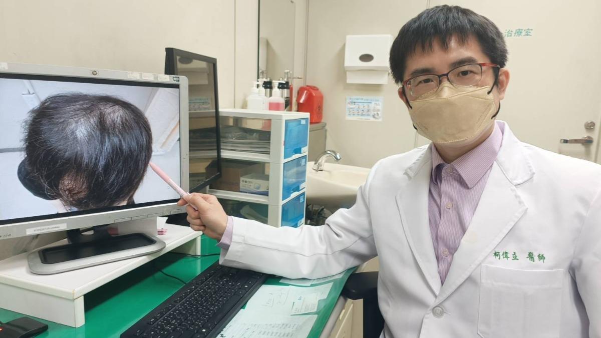 狂掉髮以為遺傳!30歲男出現不癢紅疹 醫一查驚罹「梅毒2期」