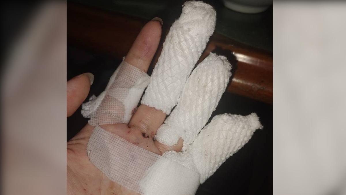 強風吹落消防梯鐵條！北市女躲信義A19　遭砸傷全身血