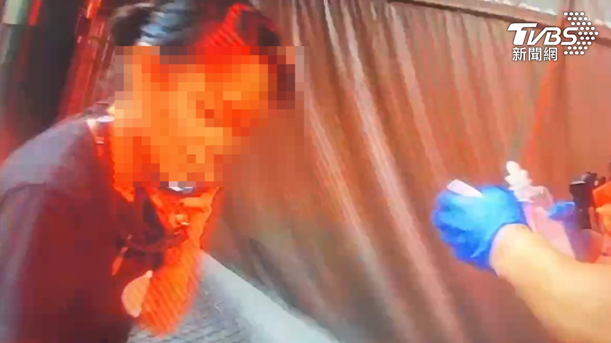 玩一半遭愛犬攻擊!臘腸犬暴衝撕裂她頭皮 血狂流送醫急救
