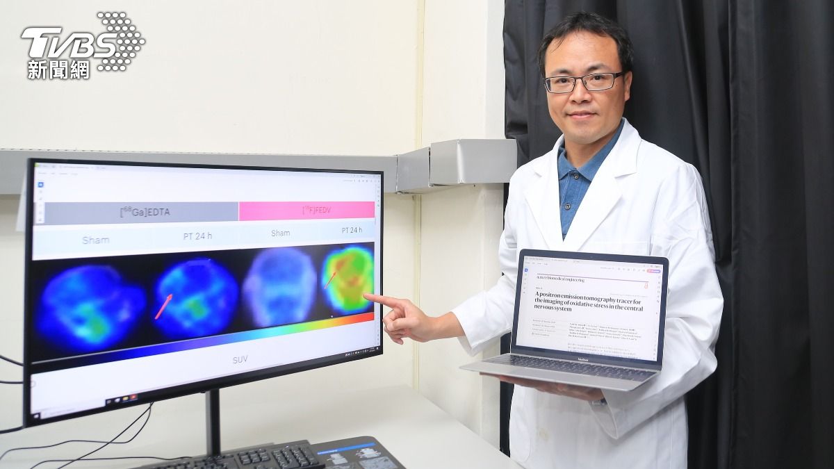 非侵入式探測顯影技術可偵測大腦中氧化壓力變化，在腦中風與神經退化性疾病發展初期及早發現治療。（圖／國立中山大學）