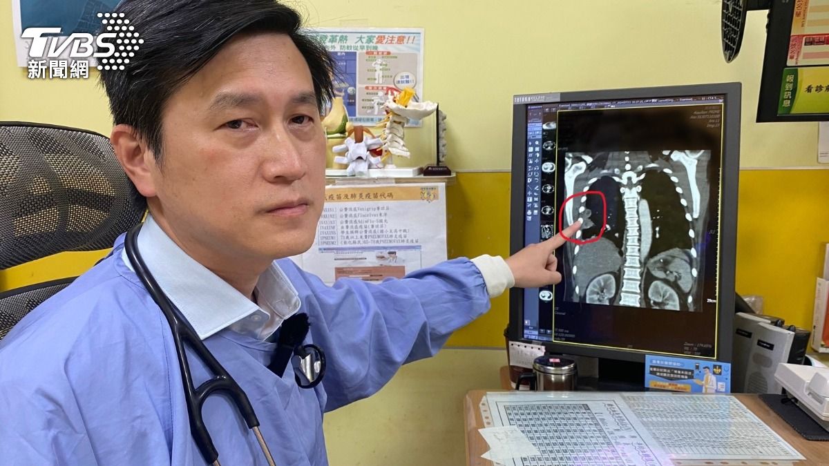 遊越南染罕病險喪命 壯男四肢截肢裝義肢奮力復健展現鋼鐵意志