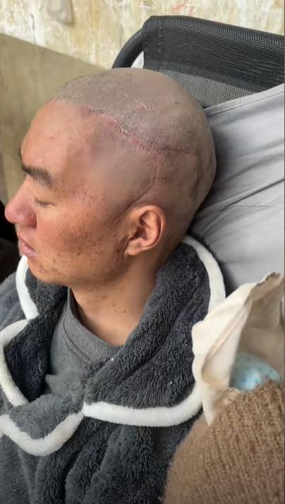 網紅小楊哥離世,網紅小楊哥去世,網紅小楊哥腦癌,小楊哥腦癌,網紅小楊哥病逝,腦癌,網紅小楊哥癌逝